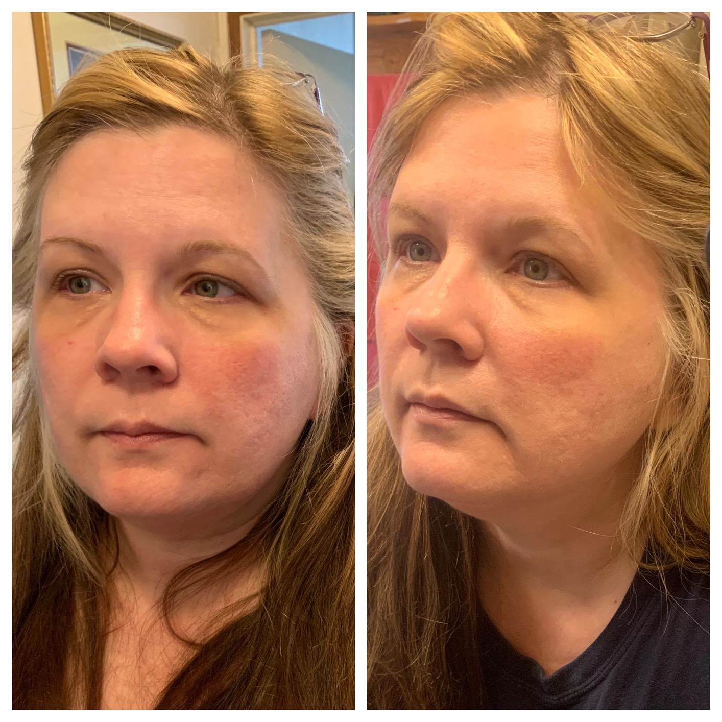 No7 Restore & Renew Face & Neck Sculpting Skincare System, 3-Piece Kit | Includes SPF 30 Day Cream, Anti-Aging Facial Serum & Hydrating Night Cream customer photo 2
