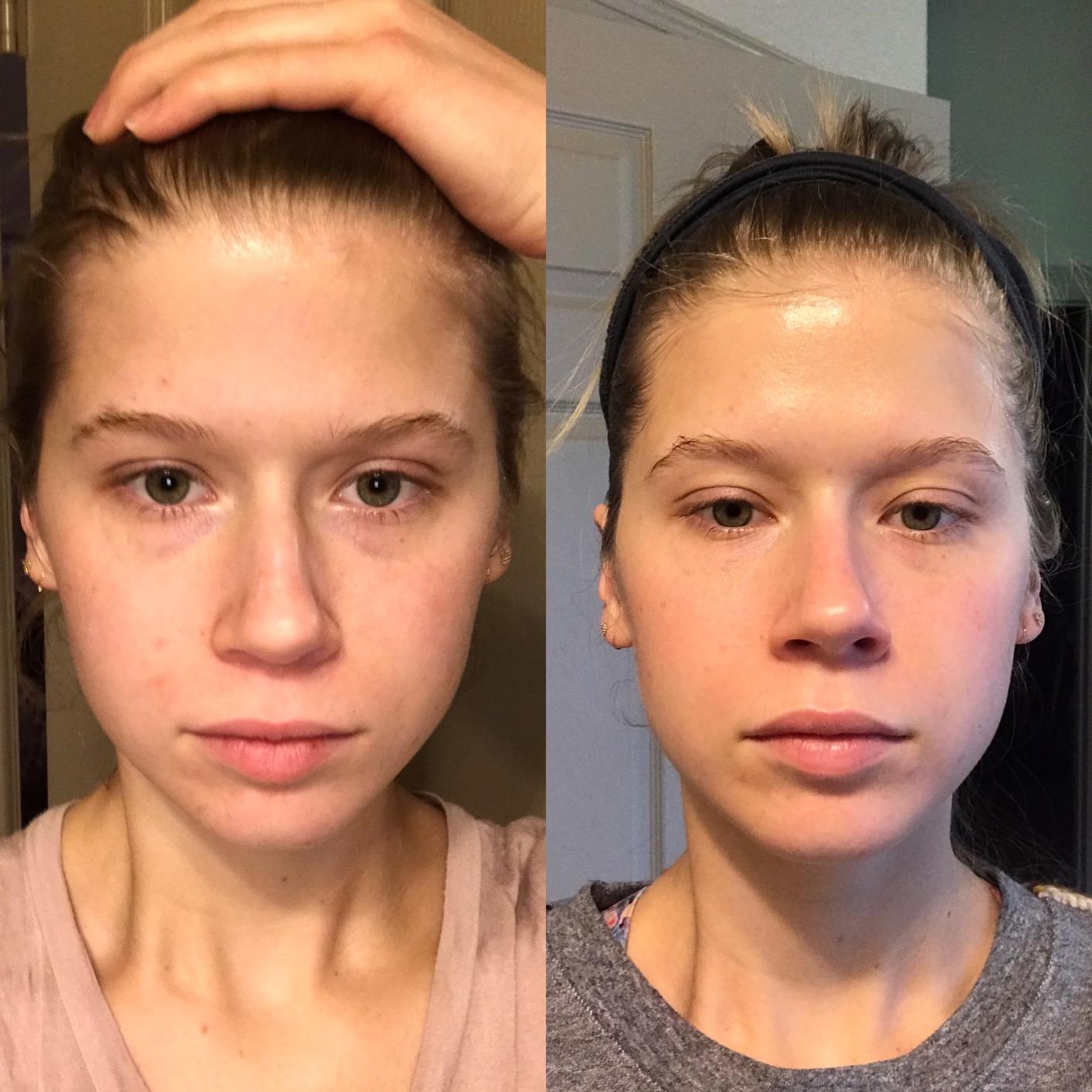 The Ordinary The Daily Set, Daily Skincare Routine with Squalane Cleanser, Hyaluronic Acid 2% + B5, and Natural Moisturizing Factors + HA | Skin Care Set customer photo 2