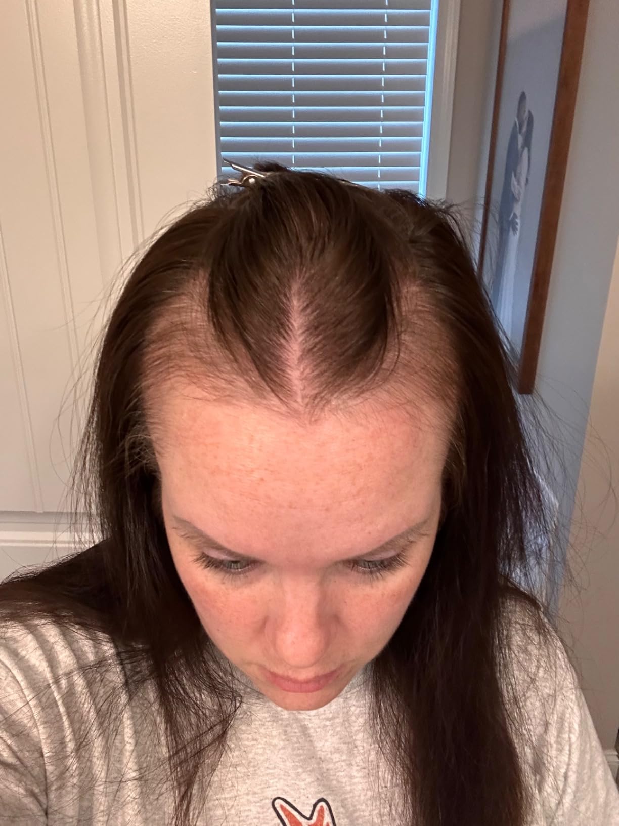 MONAT IR Clinical System - Complete Hair Care Restoration Kit with Thickening Shampoo, Conditioner & Thinning Defense Serum - Strengthens, Protects, & Revives Hair for Thicker, Fuller-Looking Results customer photo 2