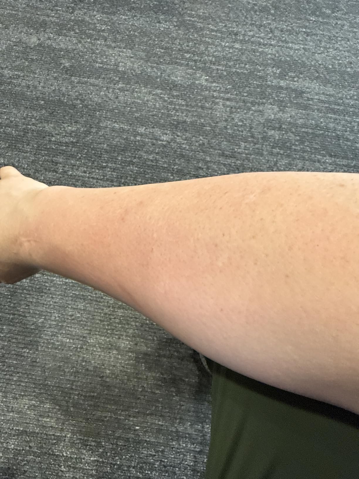 Ulike Laser Hair Removal Device Air 10 IPL for Women and Men, Ice Cool and Permanent Hair Reduction for Nearly Painless, Dual Lights, Skin Sensor & USHR Mode Hair Removal in 10mins from Home customer photo 1