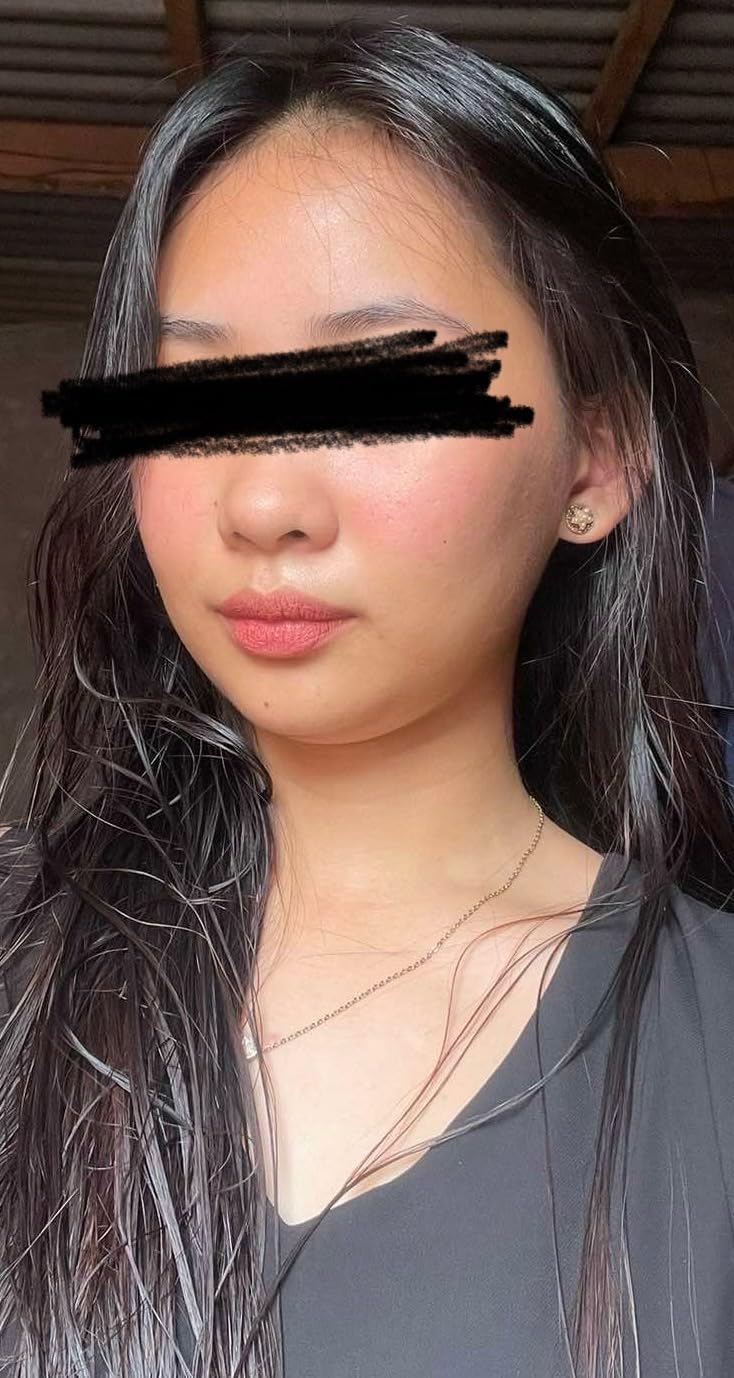Anua 3-Step Glass Skin Beginner Kit | Oil Cleanser and Face Wash with Facial Serum, Double Cleansing Daily Routine with Niacinamide, Korean Skincare customer photo 2
