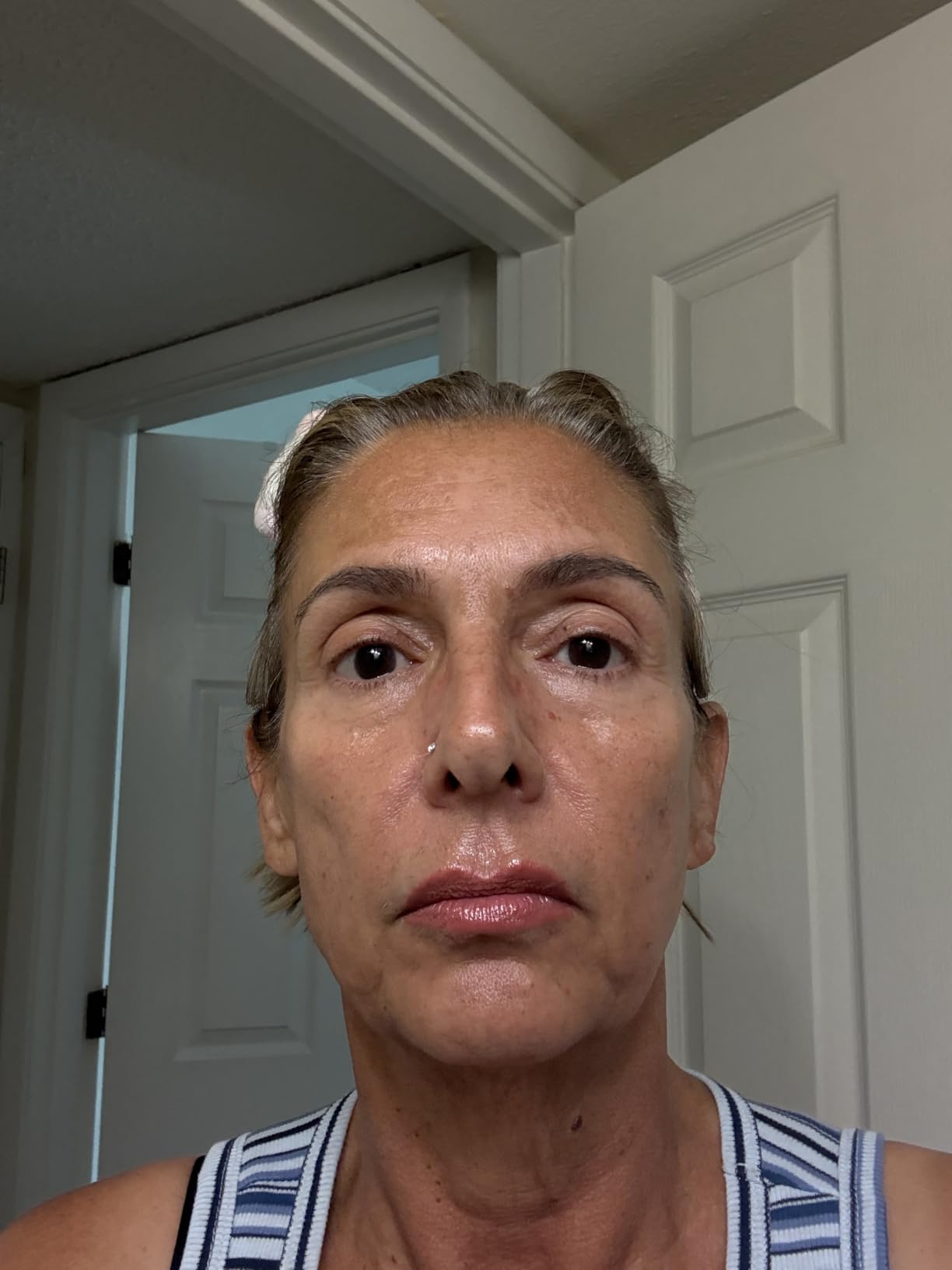The Ordinary Age Support Set - 3-Step Anti-Aging Skin Regimen with Multi-Peptide + HA, Multi-Peptide Eye Serum, and Natural Moisturizing Factors + PhytoCeramides customer photo 1