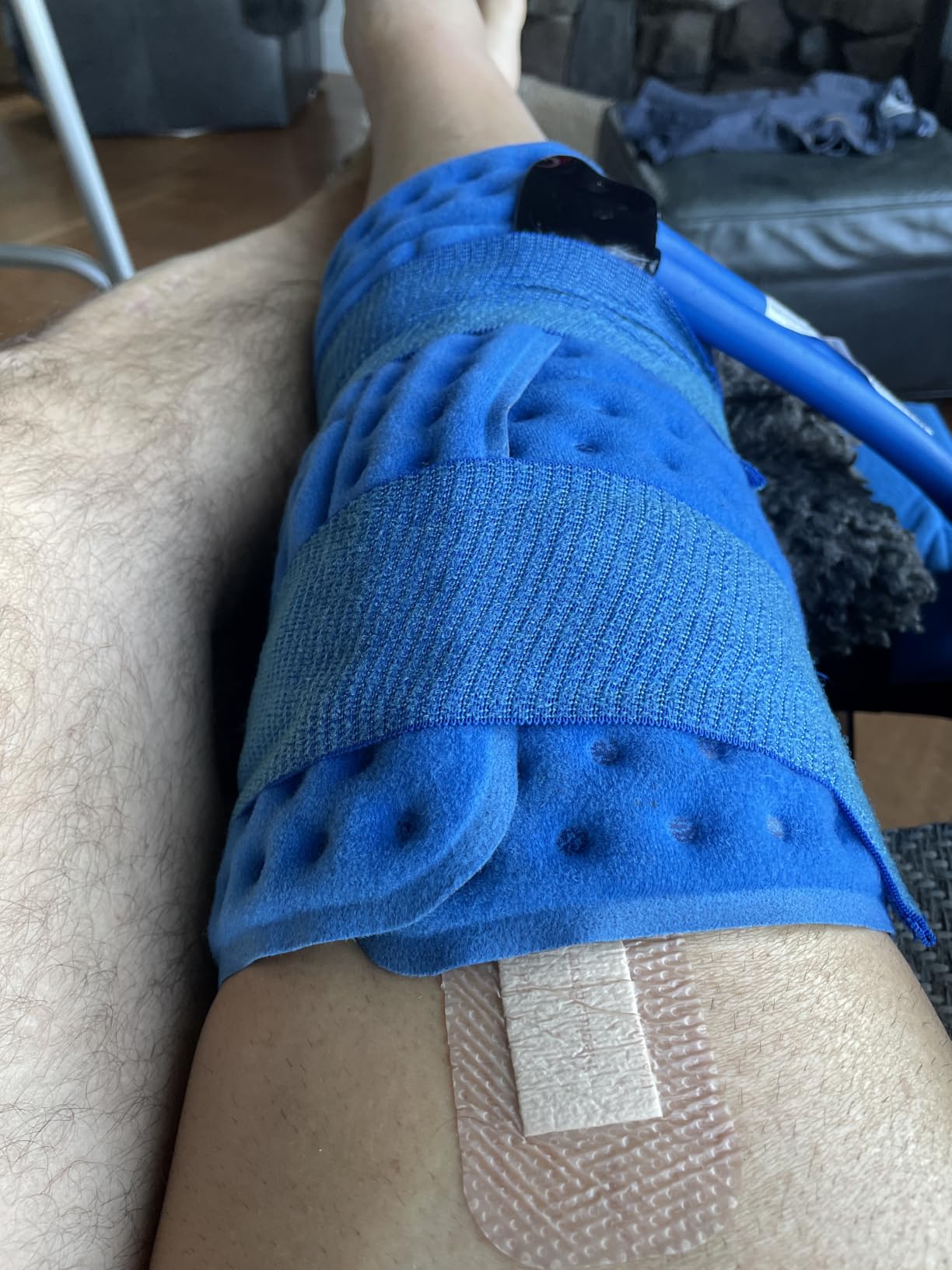 Polar Active Ice 3.0 | 9 QT Cold Therapy Ice Machine | Programmable Timer | Knee & Joint Pad | Cryotherapy Pain Relief System | Ace Bandage Style Compression customer photo 1